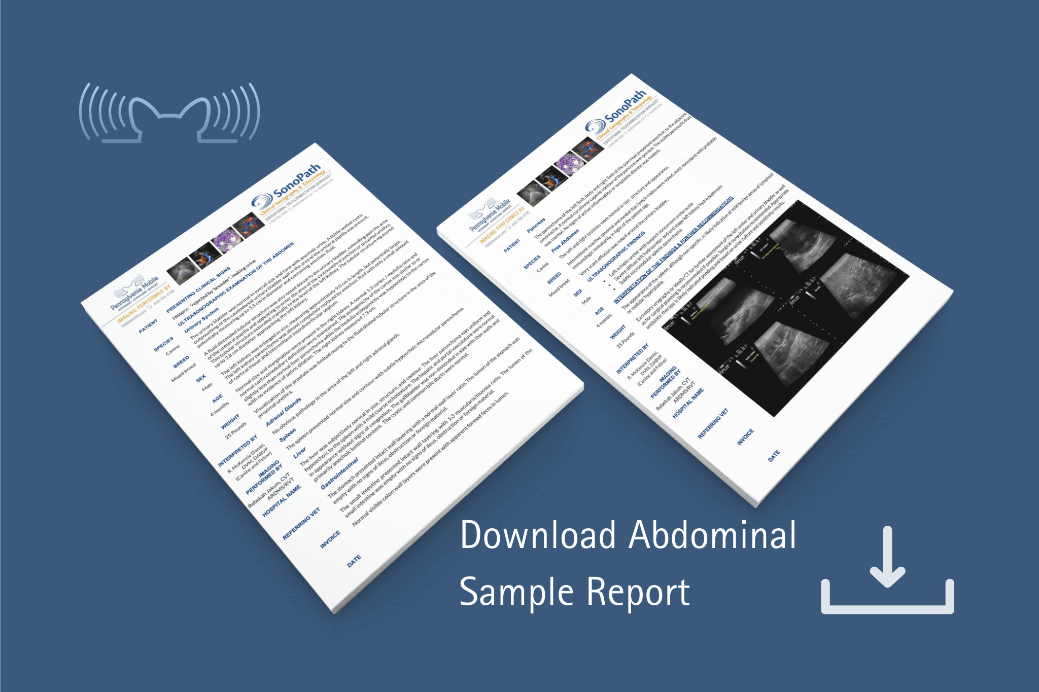 PA Mobile - Sample Abdomen Report